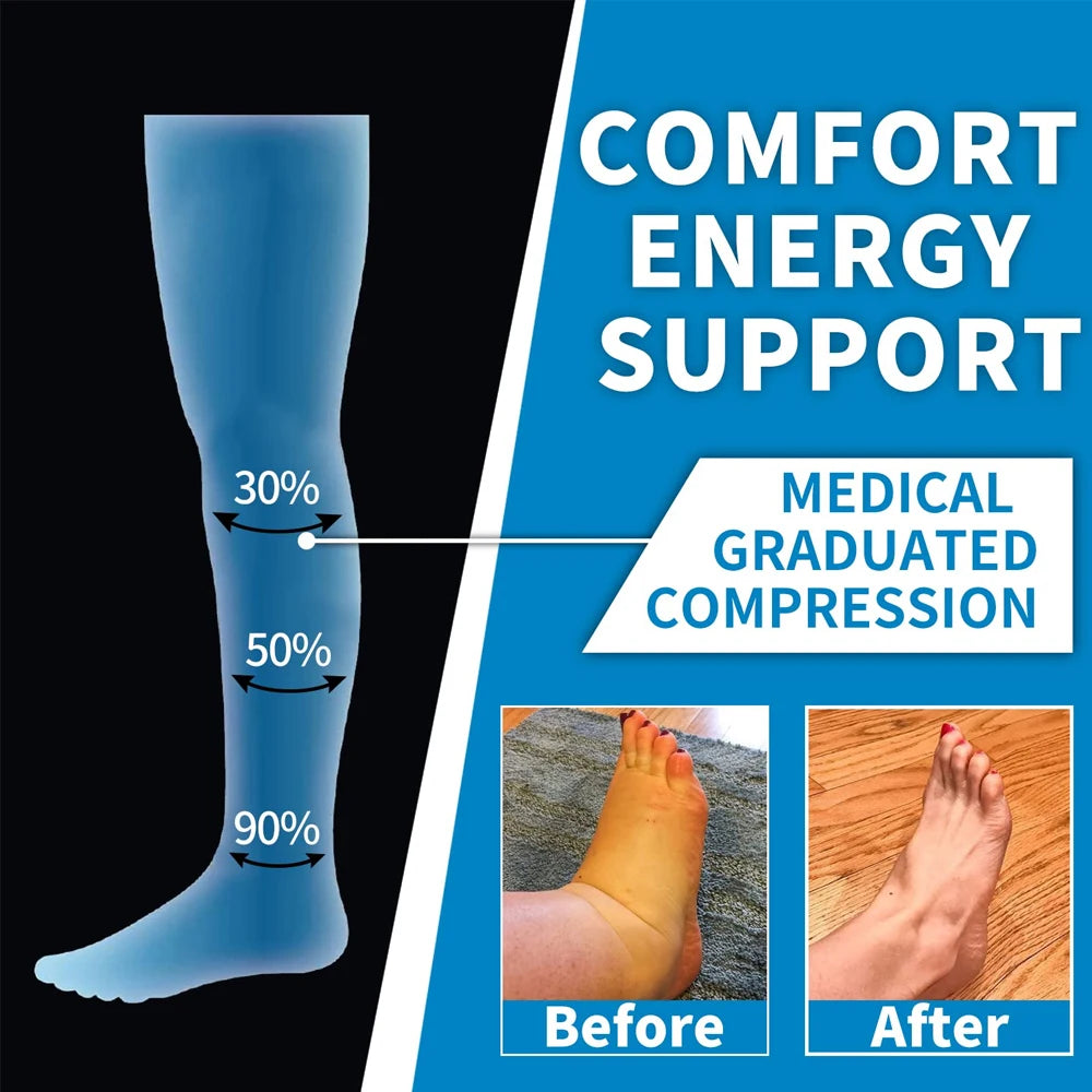 Illustration of medical graduated compression levels for calf support, featuring before and after images of ankle swelling.