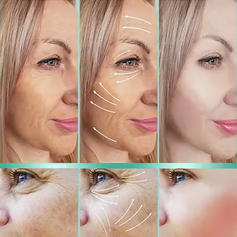 Before and after images showing skin improvement with Vitamin E serum, highlighting reduction in wrinkles and pigmentation.