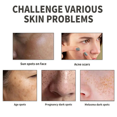 Collage showcasing various skin issues: sun spots, acne scars, age spots, pregnancy dark spots, and melasma.
