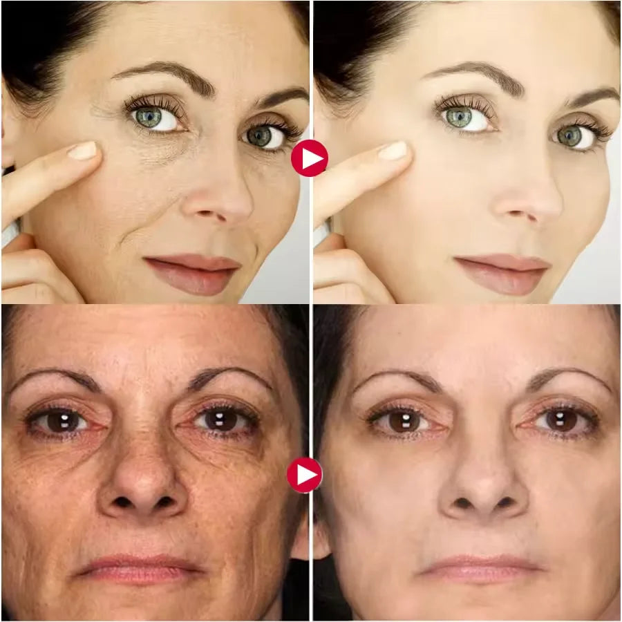 Before and after results of vitamin E face essence capsule serum for anti-aging and skin rejuvenation.