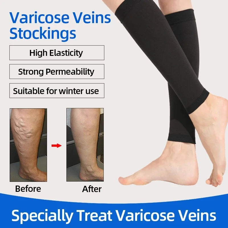 Compression stockings for varicose veins, highlighting before and after results with high elasticity and winter suitability.