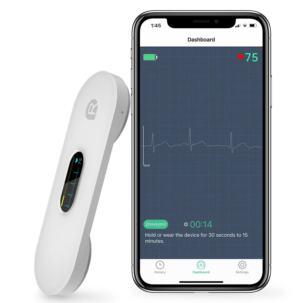 Pocket ECG monitor with OLED display, AI analysis, and mobile app for heart monitoring and analysis.