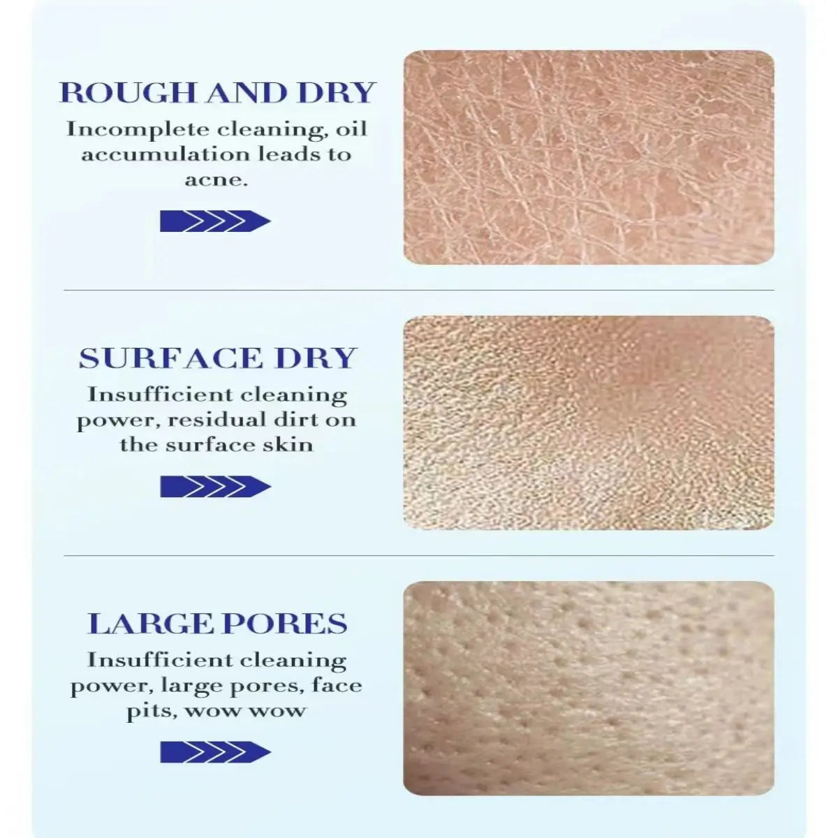 Illustration detailing skin conditions: Rough and dry, surface dry, and large pores with descriptions.