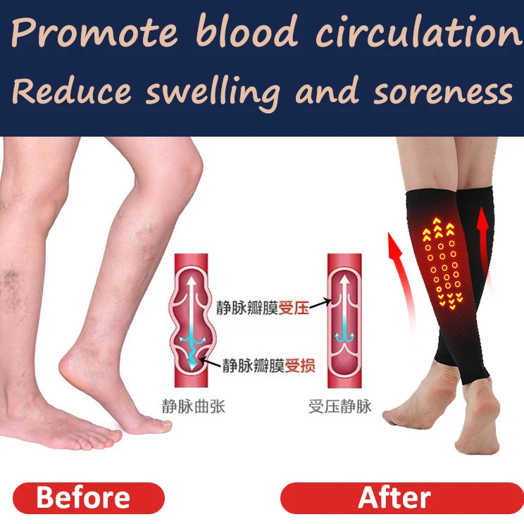 Comparison image showing effects of compression stockings on blood circulation and swelling, before and after wearing.
