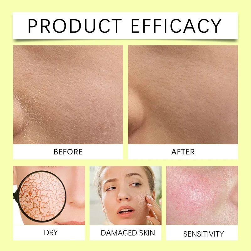 Before and after images showing the efficacy of a nourishing face serum for dry and sensitive skin care.