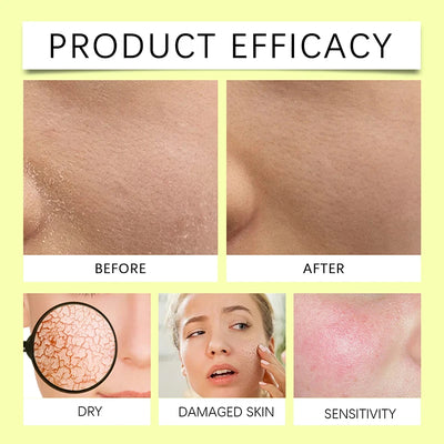 Before and after images showing the efficacy of a nourishing face serum for dry and sensitive skin care.