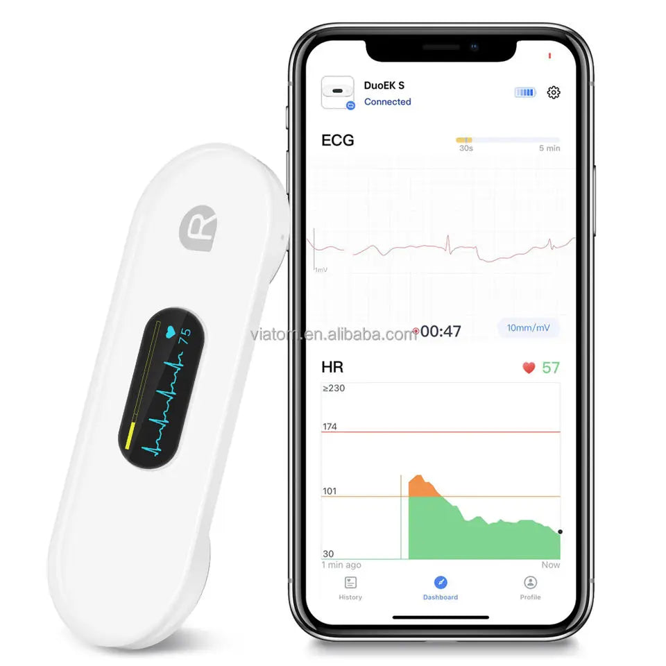 Pocket ECG monitor with OLED display showing heart activity on smartphone app, featuring AI analysis and user-friendly design.