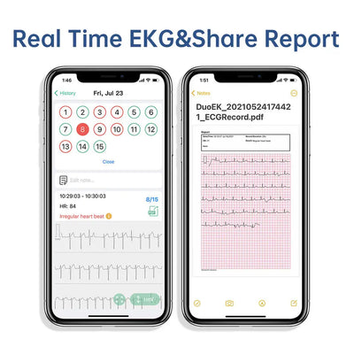 Real-time EKG report shared on smartphone, displaying heart rhythm and data analysis from health app.
