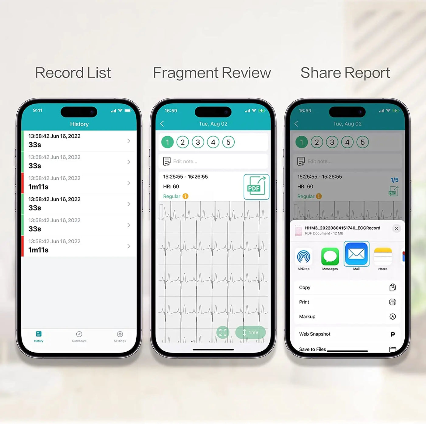 Screenshots of Pocket ECG Monitor app showing record history, fragment review, and report sharing features.