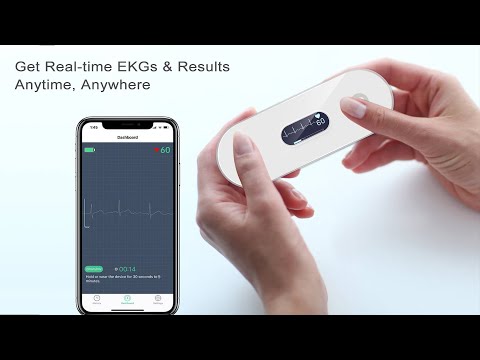 Pocket ECG monitor with smartphone app displaying real-time EKG results, compact and easy to use anywhere.